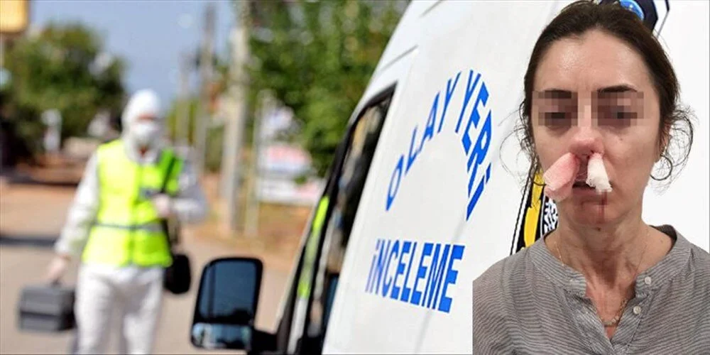 Kocasının sevgilisine benzetip dayak attı: “Pardon” deyip kaçtı