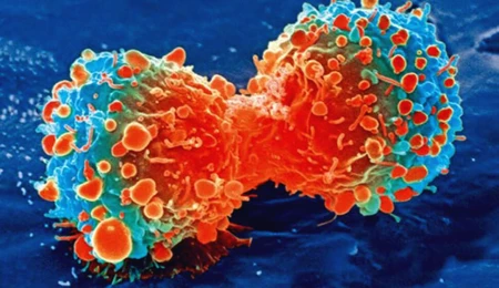 “Sessiz katil”e karşı yeni umut: Mekanizma bozulunca tümörler küçüldü