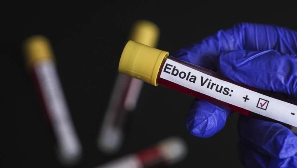 Araştırmacılar: Ebola virüsü beyinde birkaç ay boyunca hayatta kalabilir